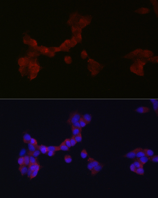 Immunofluorescence analysis of SH-SY5Y cells using DAB1 Polyclonal Antibody at dilution of 1:200 (40x lens). Blue: DAPI for nuclear staining.