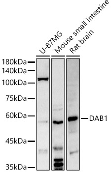 Western blot analysis of extracts of various cell lines using DAB1 Polyclonal Antibody at 1:500 dilution.