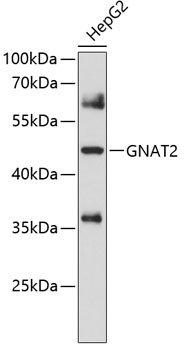 Western blot analysis of extracts of HepG2 cells using GNAT2 Polyclonal Antibody at 1:1000 dilution.