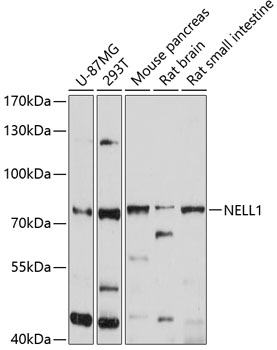 Western blot analysis of extracts of various cell lines using NELL1 Polyclonal Antibody at 1:1000 dilution.