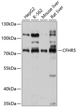 Western blot analysis of extracts of various cell lines using CFHR5 Polyclonal Antibody at 1:1000 dilution.