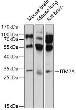 Western blot analysis of extracts of various cell lines using ITM2A Polyclonal Antibody at 1:1000 dilution.