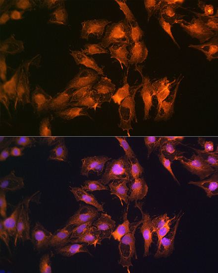 Immunofluorescence analysis of C6 cells using S100A14 Polyclonal Antibody at dilution of 1:100 (40x lens). Blue: DAPI for nuclear staining.