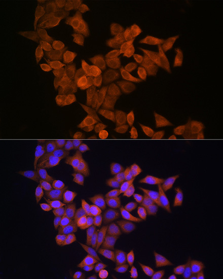 Immunofluorescence analysis of HeLa cells using S100A14 Polyclonal Antibody at dilution of 1:100 (40x lens). Blue: DAPI for nuclear staining.