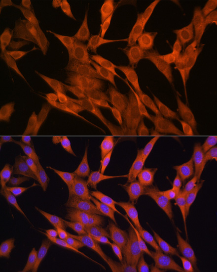 Immunofluorescence analysis of NIH-3T3 cells using S100A14 Polyclonal Antibody at dilution of 1:100 (40x lens). Blue: DAPI for nuclear staining.