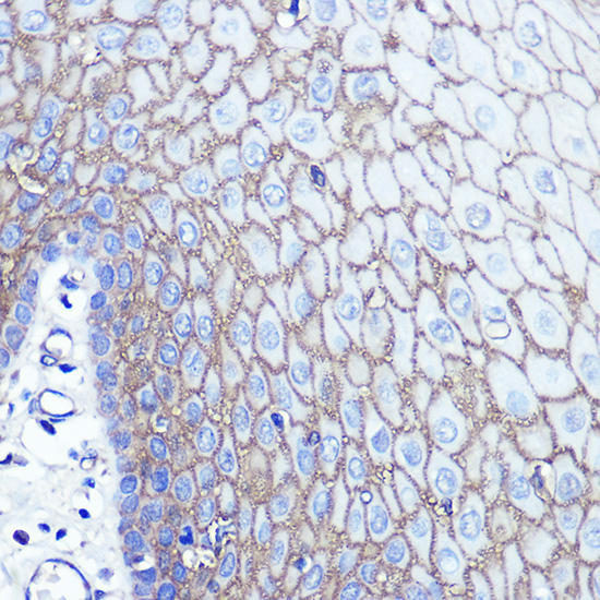 Immunohistochemistry of paraffin-embedded human esophageal using S100A14 Polyclonal Antibody at dilution of 1:100 (40x lens).Perform microwave antigen retrieval with 10 mM PBS buffer pH 7.2 before commencing with IHC staining protocol.