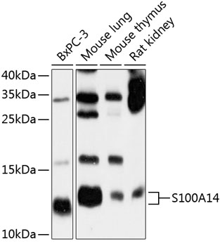 Western blot analysis of extracts of various cell lines using S100A14 Polyclonal Antibody at 1:1000 dilution.