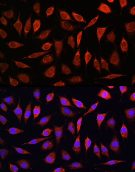 Immunofluorescence analysis of L929 cells using ZIP8 Polyclonal Antibody at dilution of 1:100. Blue: DAPI for nuclear staining.