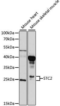 Western blot analysis of extracts of various cell lines using STC2 Polyclonal Antibody at 1:1000 dilution.