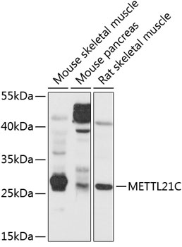 Western blot analysis of extracts of various cell lines using METTL21C Polyclonal Antibody at 1:1000 dilution.