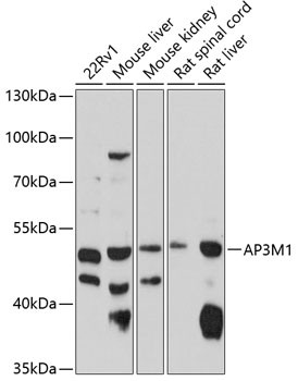 Western blot analysis of extracts of various cell lines using AP3M1 Polyclonal Antibody at 1:1000 dilution.