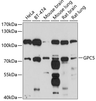 Western blot analysis of extracts of various cell lines using GPC5 Polyclonal Antibody at 1:1000 dilution.