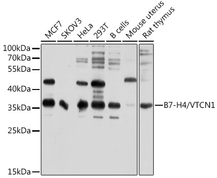 Western blot analysis of extracts of various cell lines using B7-H4/VTCN1 Polyclonal Antibody at 1:1000 dilution.