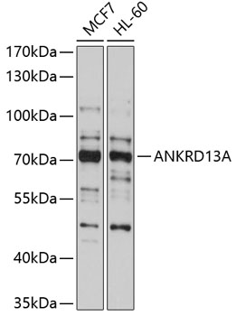 Western blot analysis of extracts of various cell lines using ANKRD13A Polyclonal Antibody at 1:1000 dilution.