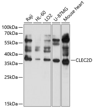 Western blot analysis of extracts of various cell lines using CLEC2D Polyclonal Antibody at 1:1000 dilution.