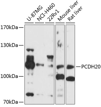 Western blot analysis of extracts of various cell lines using PCDH20 Polyclonal Antibody at 1:1000 dilution.