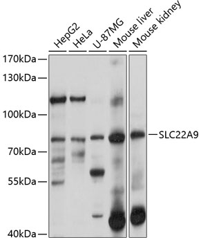 Western blot analysis of extracts of various cell lines using SLC22A9 Polyclonal Antibody at 1:1000 dilution.