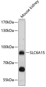 Western blot analysis of extracts of mouse kidney using SLC6A15 Polyclonal Antibody at 1:1000 dilution.