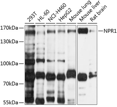 Western blot analysis of extracts of various cell lines using NPR1 Polyclonal Antibody at 1:1000 dilution.