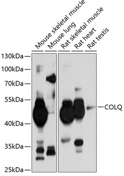 Western blot analysis of extracts of various cell lines using COLQ Polyclonal Antibody at 1:1000 dilution.