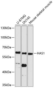 Western blot analysis of extracts of various cell lines using HAS1 Polyclonal Antibody at 1:1000 dilution.