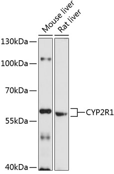 Western blot analysis of extracts of various cell lines using CYP2R1 Polyclonal Antibody at 1:1000 dilution.