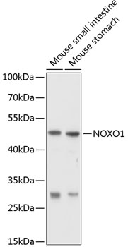 Western blot analysis of extracts of various cell lines using NOXO1 Polyclonal Antibody at 1:1000 dilution.