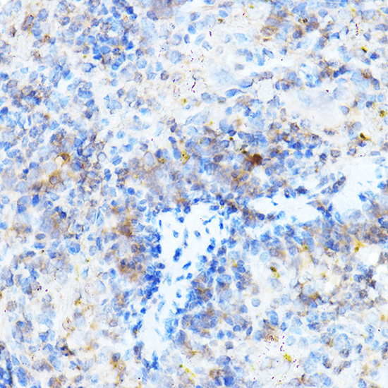 Immunohistochemistry of paraffin-embedded mouse spleen using ULBP1 Polyclonal Antibody at dilution of 1:500 (40x lens).Perform high pressure antigen retrieval with 10 mM citrate buffer pH 6.0 before commencing with IHC staining protocol.