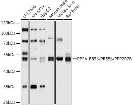 Western blot analysis of extracts of various cell lines using PP2A-B55β/PR55β/PP2A-B55β/PR55β/PPP2R2B Polyclonal Antibody at 1:1000 dilution.