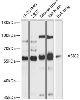 Western blot analysis of extracts of various cell lines using ASIC2 Polyclonal Antibody at 1:1000 dilution.