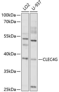 Western blot analysis of extracts of various cell lines using CLEC4G Polyclonal Antibody at 1:1000 dilution.