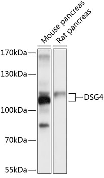 Western blot analysis of extracts of various cell lines using DSG4 Polyclonal Antibody at 1:1000 dilution.