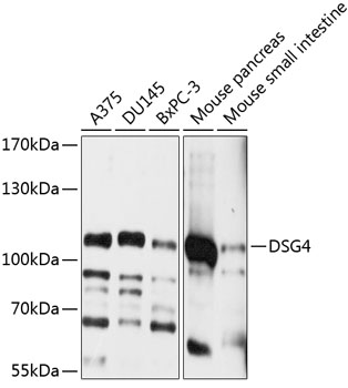 Western blot analysis of extracts of various cell lines using DSG4 Polyclonal Antibody at 1:1000 dilution.