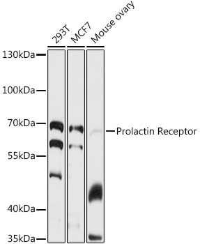 Western blot analysis of extracts of various cell lines using Prolactin Receptor Polyclonal Antibody at 1:1000 dilution.