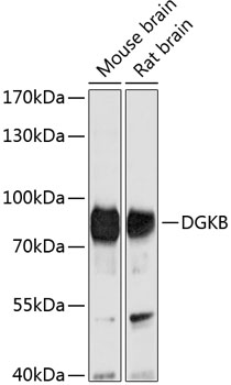 Western blot analysis of extracts of various cell lines using DGKB Polyclonal Antibody at 1:1000 dilution.