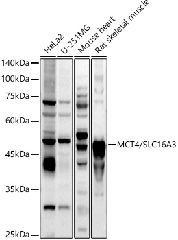 Western blot analysis of extracts of various cell lines using MCT4/SLC16A3 Polyclonal Antibody at 1:1000 dilution.