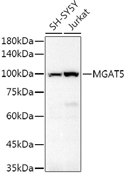 Western blot analysis of extracts of various cell lines using GNT-V/MGAT5 Polyclonal Antibody at 1:500 dilution.