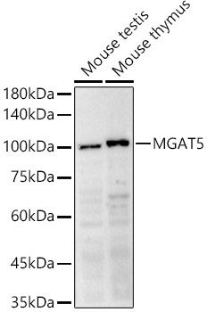 Western blot analysis of extracts of various cell lines using GNT-V/MGAT5 Polyclonal Antibody antibody at 1:500 dilution.