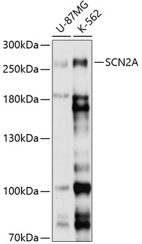 Western blot analysis of extracts of various cell lines using SCN2A Polyclonal Antibody at 1:1000 dilution.