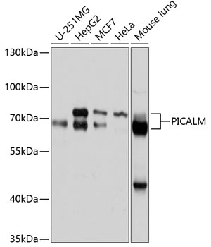 Western blot analysis of extracts of various cell lines using PICALM Polyclonal Antibody at 1:1000 dilution.