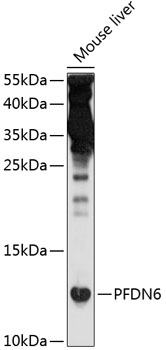 Western blot analysis of extracts of mouse liver using PFDN6 Polyclonal Antibody at 1:1000 dilution.