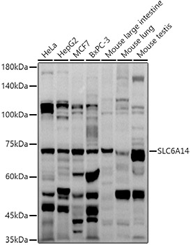 Western blot analysis of extracts of various cell lines using SLC6A14 Polyclonal Antibody at 1:1000 dilution.