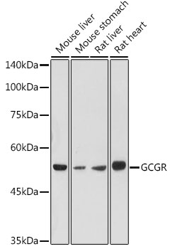 Western blot analysis of extracts of various cell lines using GCGR Polyclonal Antibody at 1:1000 dilution.