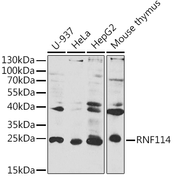 Western blot analysis of extracts of various cell lines using RNF114 Polyclonal Antibody at 1:1000 dilution.