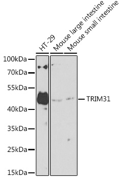 Western blot analysis of extracts of various cell lines using TRIM31 Polyclonal Antibody at 1:1000 dilution.