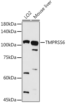 Western blot analysis of extracts of various cell lines using TMPRSS6 Polyclonal Antibody at 1:1000 dilution.