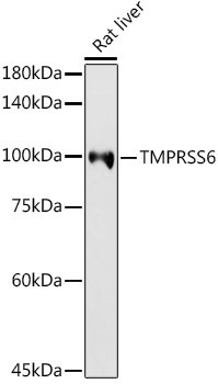 Western blot analysis of extracts of Rat liver using TMPRSS6 Polyclonal Antibody at 1:1000 dilution.