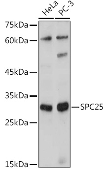 Western blot analysis of extracts of various cell lines using SPC25 Polyclonal Antibody at 1:1000 dilution.