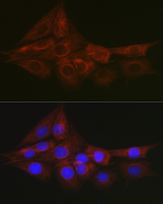 Immunofluorescence analysis of PC-12 cells using Glutathione Synthetase Polyclonal Antibody at dilution of 1:100. Blue: DAPI for nuclear staining.