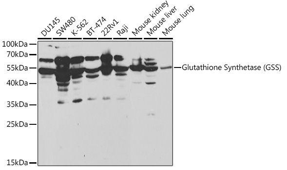 Western blot analysis of extracts of various cell lines using Glutathione Synthetase Polyclonal Antibody at1:1000 dilution.